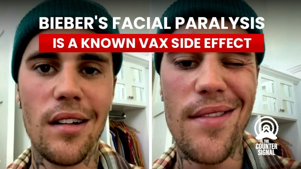Bieber's paralysis is a vax side effect